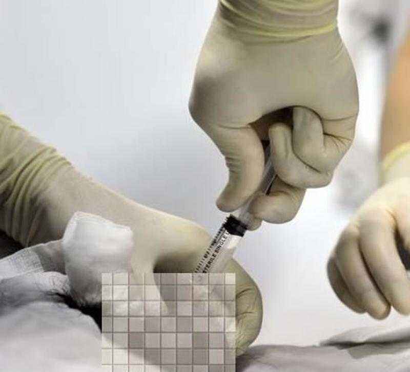 试管婴儿移植后症状有哪些?