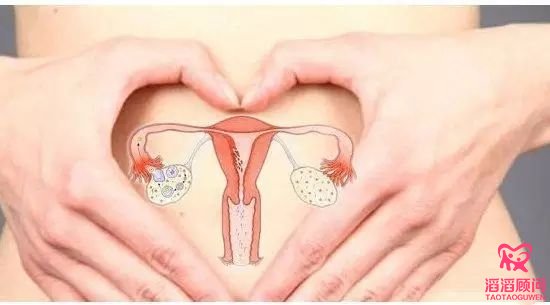 俄罗斯试管婴儿