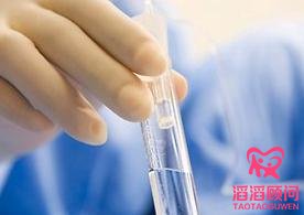 试管婴儿