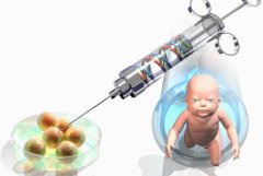 俄罗斯试管婴儿技术取卵是如何止疼的？