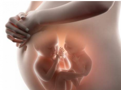 试管婴儿多胞胎减胎在什么情况下进行？