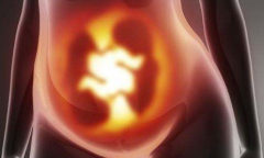 俄罗斯试管婴儿可以移植几枚胚胎？